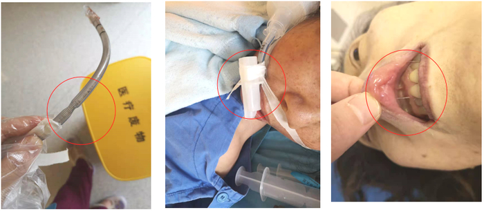 格力电器获得实用新型专利授权:“一种用于空调压缩机破壳拆解的运输线体”