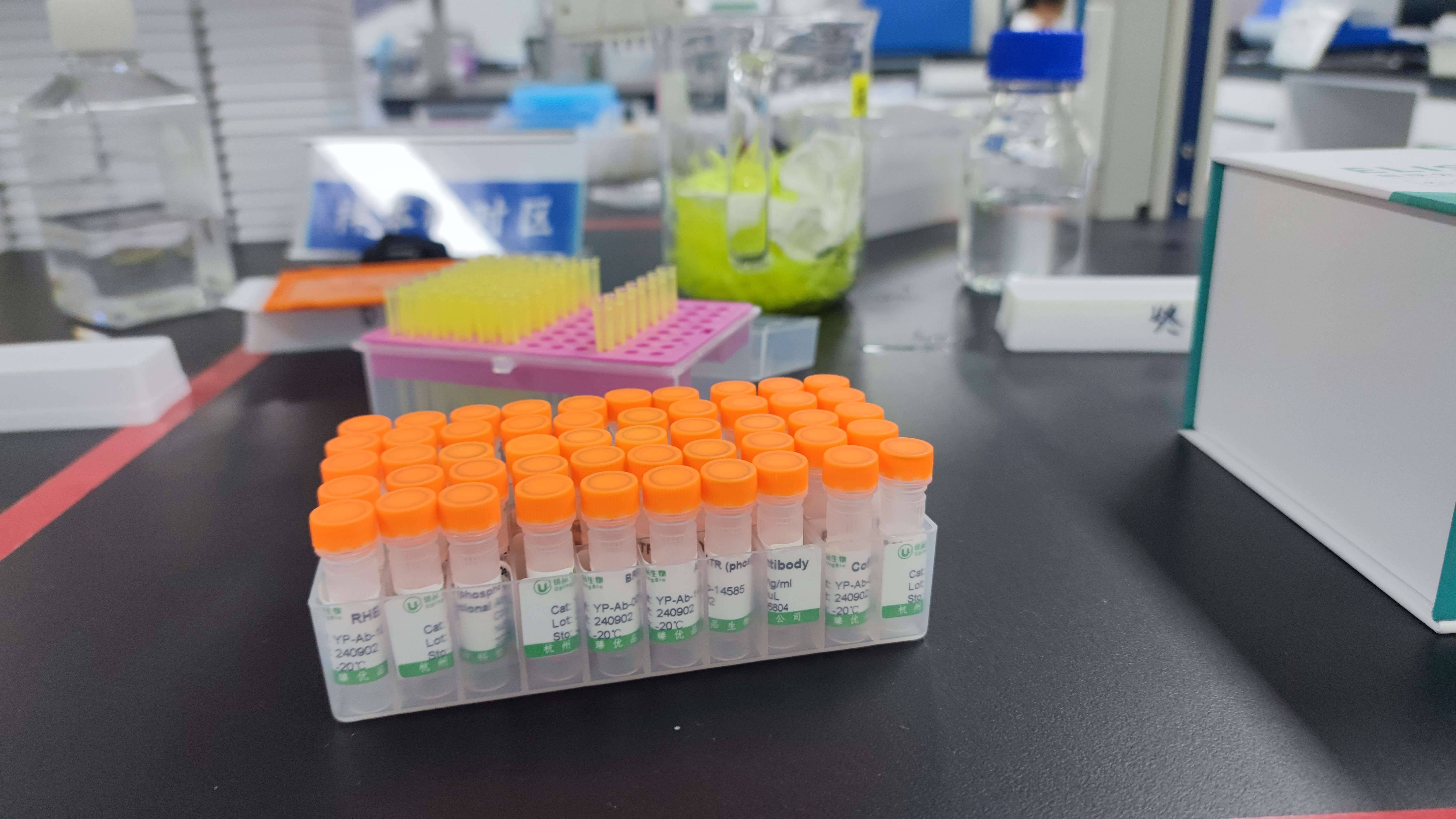 新研究制备出有望对抗耐药性“超级细菌”的抗体