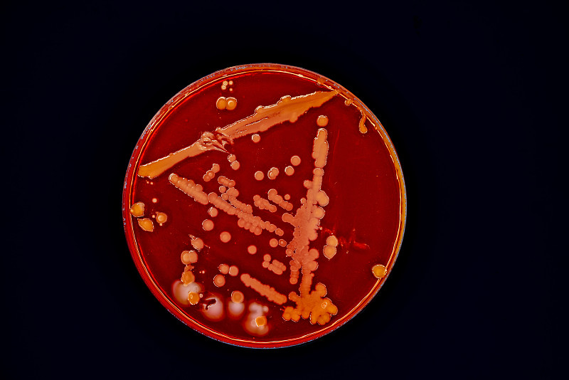 东富龙获得实用新型专利授权:“一种洁净室内培养皿微生物检测辅助装置”