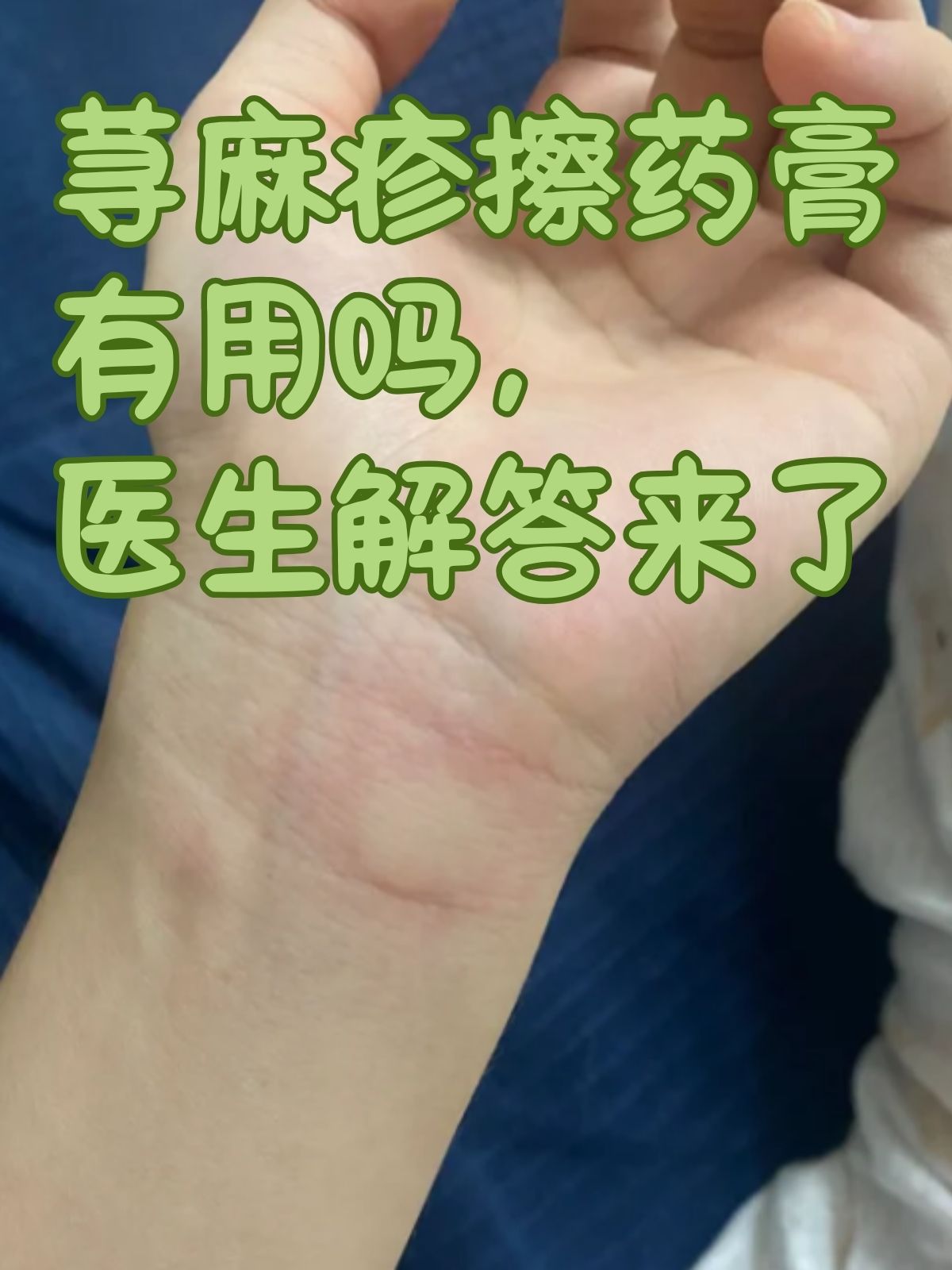 贝泰妮获得发明专利授权：“一种具有抗炎抗过敏功效的组合物及其应用”