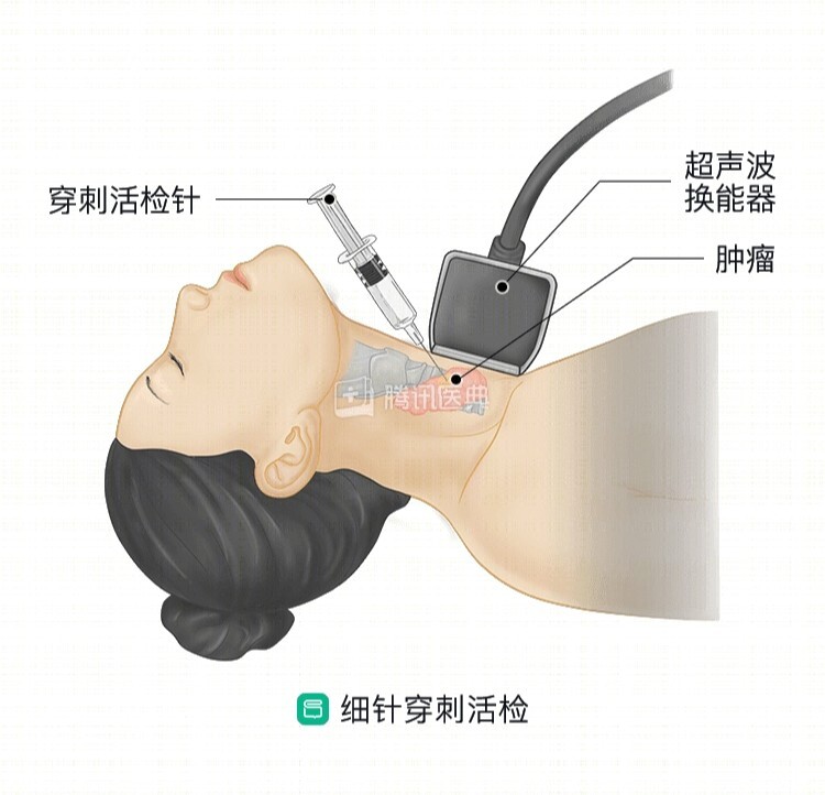 维力医疗获得实用新型专利授权:“一种用于活检针的自动锁针结构”